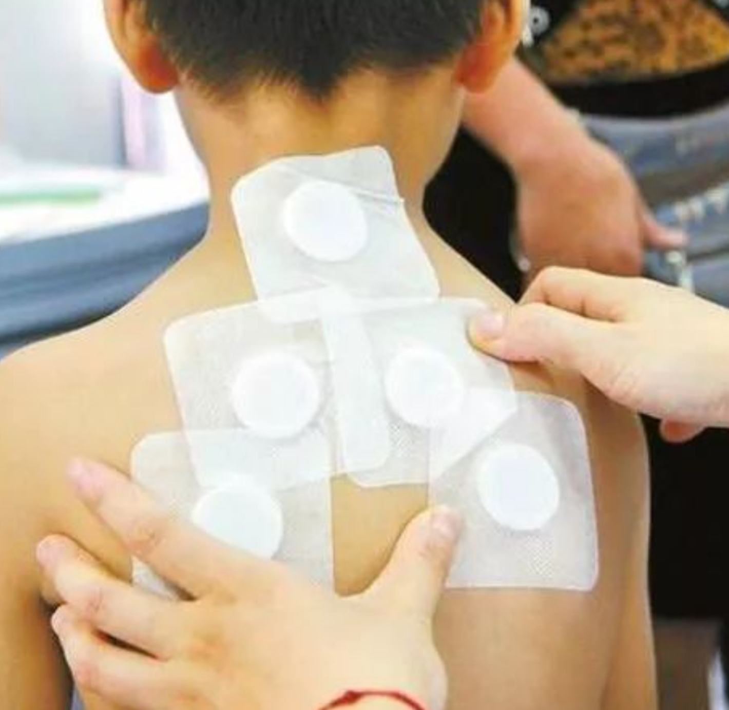 2、三伏貼在脖子上，有一根針，看起來很疼。怎么了